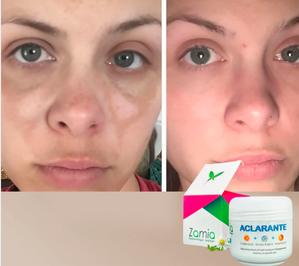 Crema Aclarante Zamia ✨ Despídete de las manchas + Envío Gratis