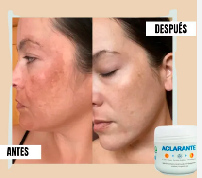 Crema Aclarante Zamia ✨ Despídete de las manchas + Envío Gratis
