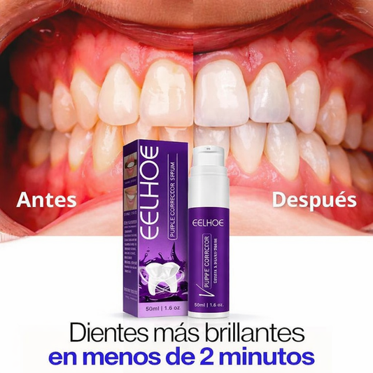 Blanqueador Dental V34™  - ¡Dientes más blancos al instante!  + Envío gratis🎁