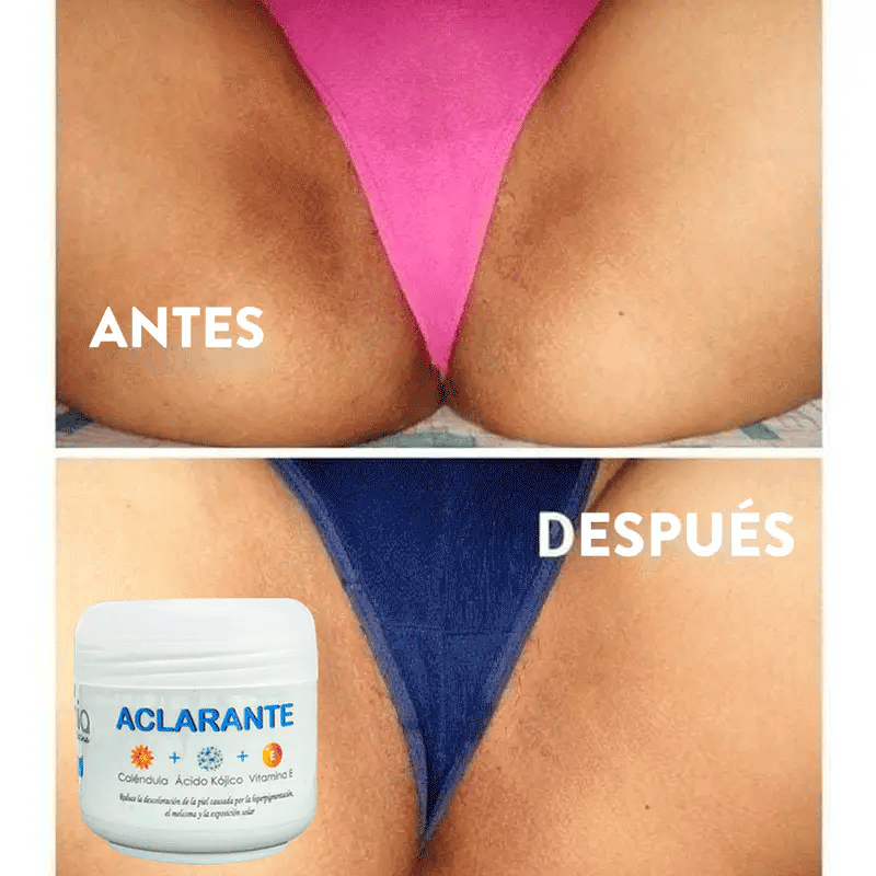 Crema Aclarante Zamia ✨ Despídete de las manchas + Envío Gratis