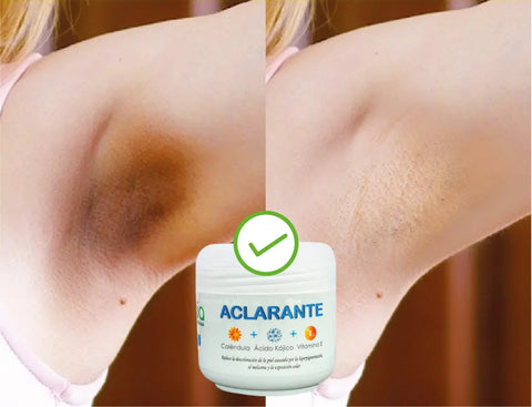 Crema Aclarante Zamia ✨ Despídete de las manchas + Envío Gratis